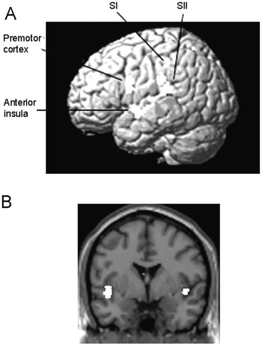 1580 Brain (2005), 128, 1571 1583 S.-J. Blakemore et al. potentials (MEPs) evoked by transcranial magnetic stimulation (TMS).