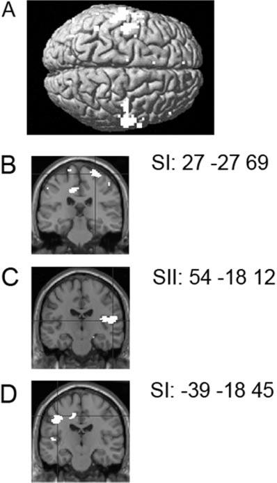 1576 Brain (2005), 128, 1571 1583 S.-J. Blakemore et al. In addition, bilateral fusiform gyrus (including the fusiform face area; Kanwisher et al.