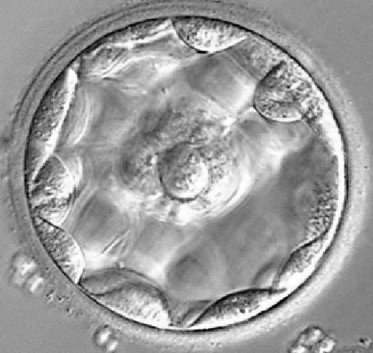 Embryo selection One of the major challenges for embryologists Selection of embryos with the highest potential to