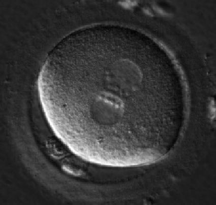 Morphological embryo