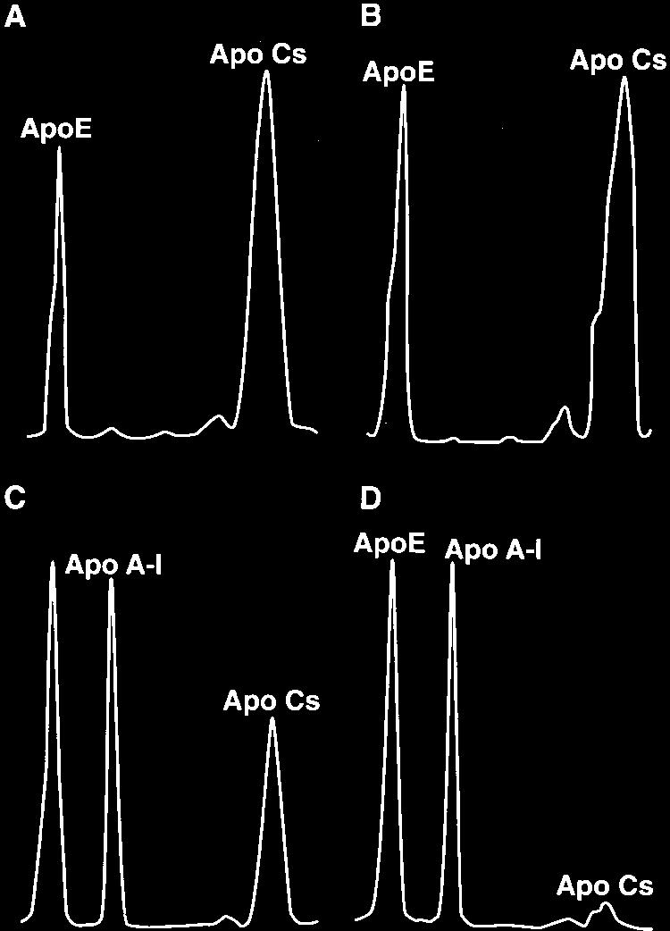 3, bottom (gel scans) are control VLDL (A), VLDL core remnants produced in the absence of HDL (B) and VLDL core remnants produced in the presence of a low HDL level (C) or a high HDL level (D).