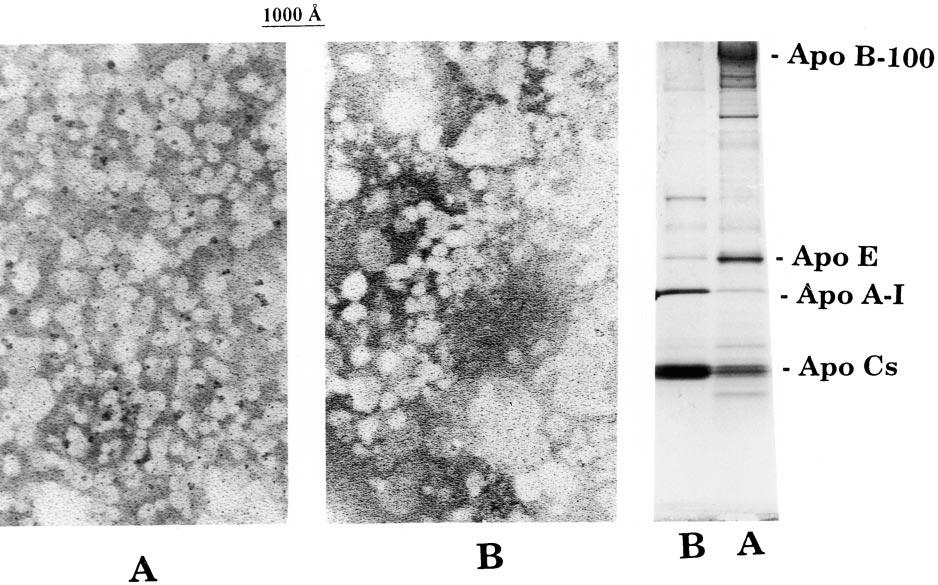 Fig. 5. Top: Electron micrographs and SDS gradient gel electrophoregrams of VLDL core remnants and sur face remnants produced in the absence of HDL.