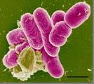 Causes of Travelers Diarrhea Etiology: Bacteria Viruses Parasites