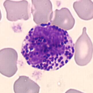 Eosinophils et basophils Basophils: Granulations stained with basic colorants (violet in MGG) Found in pathological tissues (parasites, allergies)