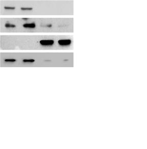 E FoxO1 -tubulin Histone H3 - + - + shrna: NT #1 # E - + - + - + Nuleus ytosol Nuleus ytosol shrna: HIF-1 HIF-1 NT #1 # NT #1 # Palitaxel - + - + - + - + - + - + - + - + - + - + - + - + FoxO1