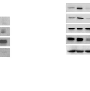 ( and ) MA-M-31 sublones expressing NT or a shrna vetor were treated without or with palitaxel (), or E () for 7 h, and immunoblot assays were performed.