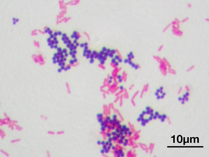 Gram stain: Differentiates bacteria into