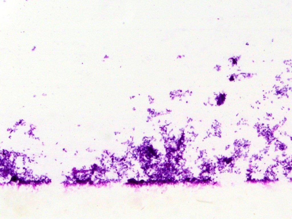 Periodic acid-schiff stain (with or