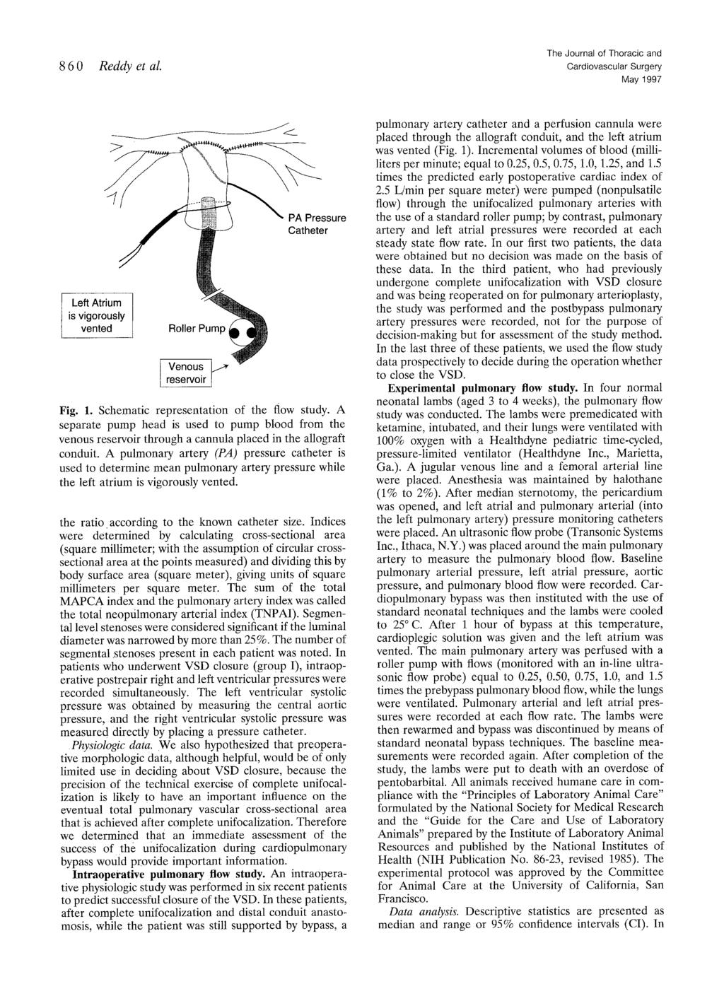 860 Red@ et al. The Journal of Thoracic and May 1997 Left Atr is vigorc vente f ssure ;r Fig. 1. Schematic representation of the flow study.