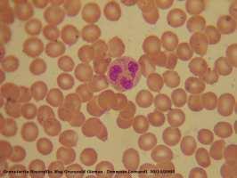 org/images/leukocytes-normal.