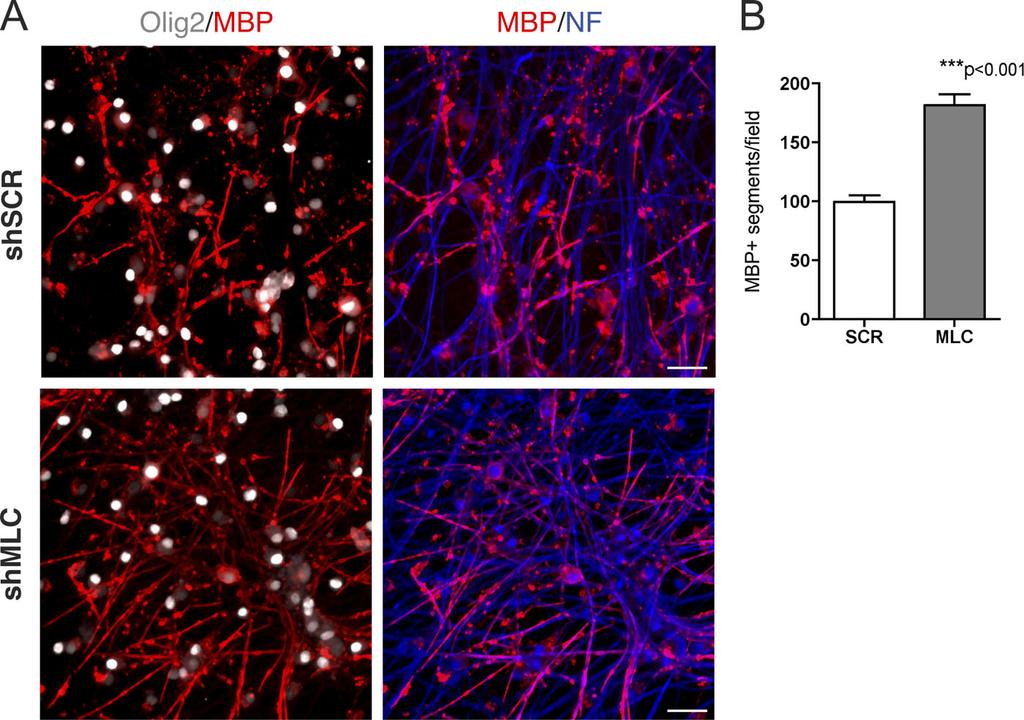 Figure 5. Knockdown of myosin II in OL- DRG cocultures enhances myelin formation. (A) 3-wk-old myelinating OL-DRG cocultures stained for MBP, Olig2, and neurofilament.