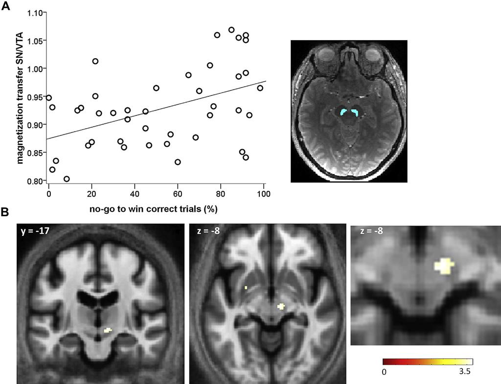 R. Chowdhury et al. / Neurobiology of Aging 34 (2013) 2261e2270 2265 Fig. 3. Higher no-go to win performance is associated with higher structural integrity of substantia nigra/ventral tegmental area (SN/VTA) and STN.
