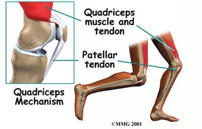 This guide will help you understand how the kneecap works why kneecap problems develop what can be done to treat these problems Anatomy What is the patella, and what does it do?