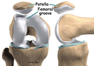 Though we think of it as a single device, the quadriceps mechanism has two separate tendons, the quadriceps tendon on top of the patella and the patellar tendon below the patella.