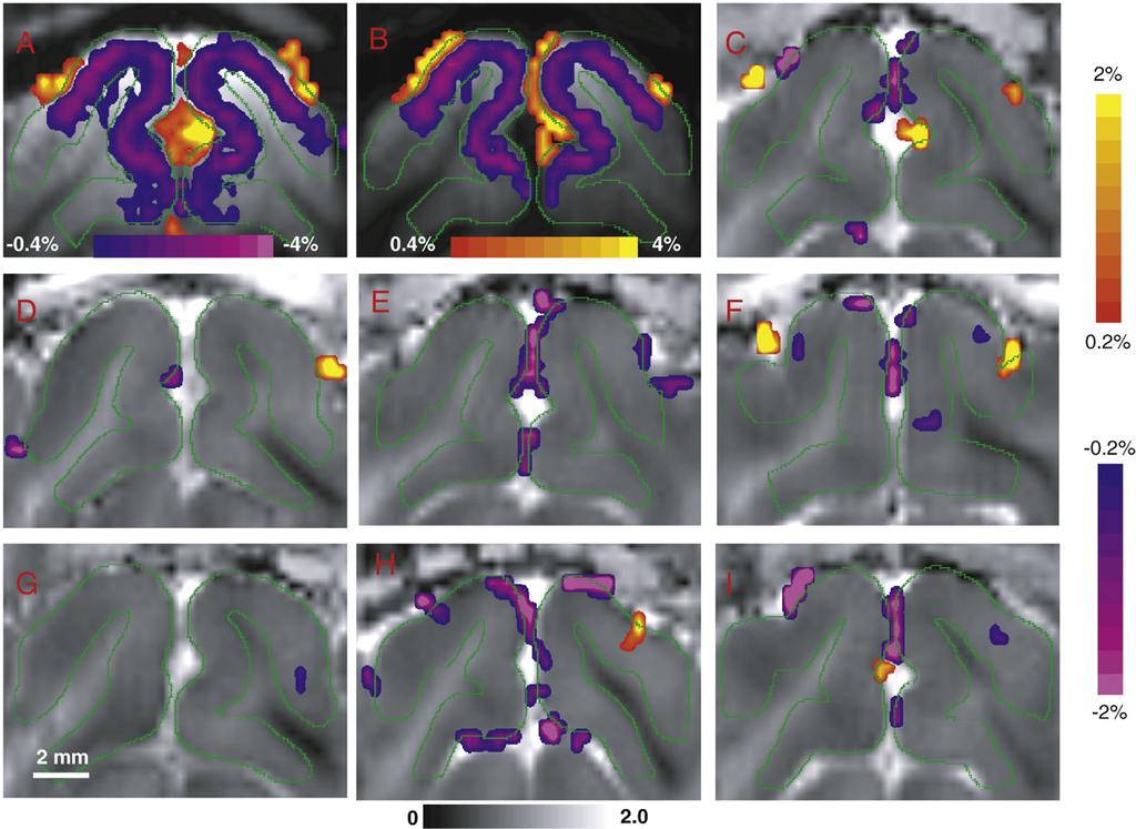 806 T. Jin, S.-G. Kim / NeuroImage 41 (2008) 801 812 Fig. 4. Functional maps of all seven animals after the removal of intravascular signals with MION.