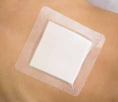 . Cilguard dressings can be applied to a variety of wounds following wound cleansing and drying the surrounding skin prior to