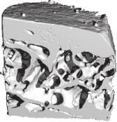 novel and unique approach in the management of osteoporosis by its ability to restore the imbalance between bone resorption and formation in favour of bone formation and by its beneficial effects on