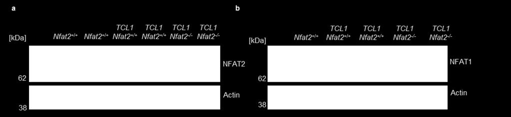 isolated splenic B cells from WT Nfat2 +/+, TCL1 Nfat2 +/+ and TCL1