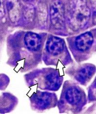 (Adipocyte, Fat Cells) Unilocular adipose cells تجويف= locular, وحيد= Uni=one Large spherical, with a single