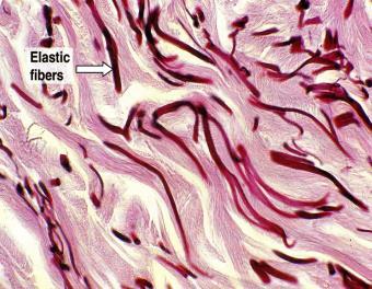 Elastic Fibers Made of collagen type I Non-branched fiber &