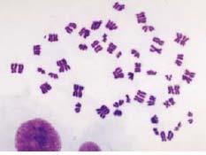 Endoreplication Chromosomes