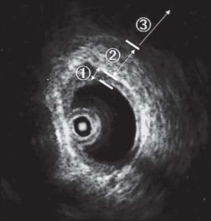 Endoscopic Ultrasound, 2015