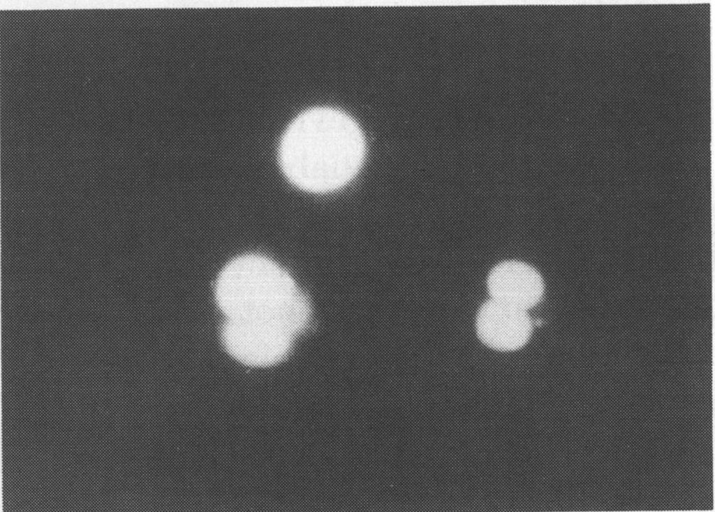 Figure 2 Five human multipronucleate embryos after cryostorage and exposure to fluorescein diacetate.
