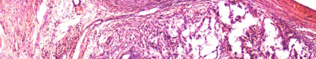 Cell Tumor with