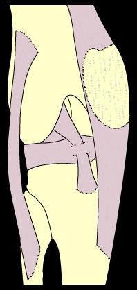 9 of 37 The structure of the knee joint (hinge) The knee is a very large and complex joint. You need to know the details of how it works.