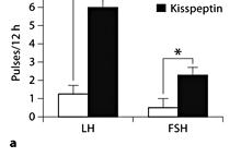 determine output Kp1 increases LH pulsatility in the