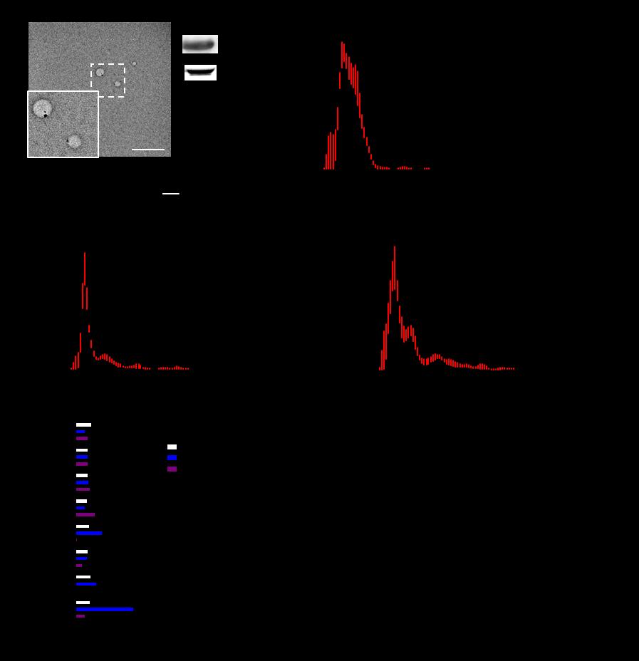 Fig. S3. EV isolation, quantitation, and liver cytokine response 24 hours after EV infusion in mice. (A) Representative electron micrograph of EV isolated from plasma. Scale bar = 100 µm.