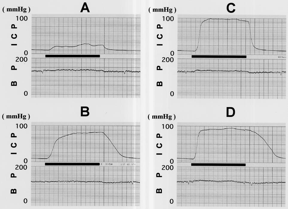 254 Figure 4 Original tracing stimulated at frequency of 2 Hz before sildenafil (A), 2 Hz after sildenafil (B), 12 Hz before sildenafil (C) and 12 Hz after sildenafil (D). to sildenafil.