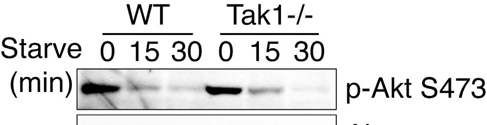 Figure S6, related to Figure 1 - Contribution of Tak1 to