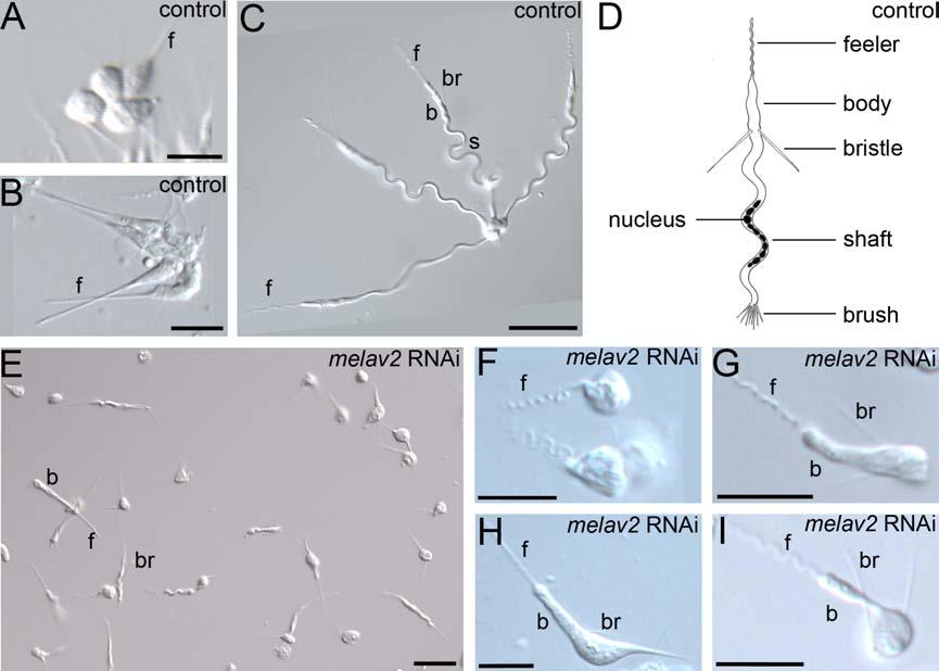 these features together, the morphological defects induced by melav2 RNAi occurred mainly in the posterior parts, which are formed in the later stages of spermiogenesis.