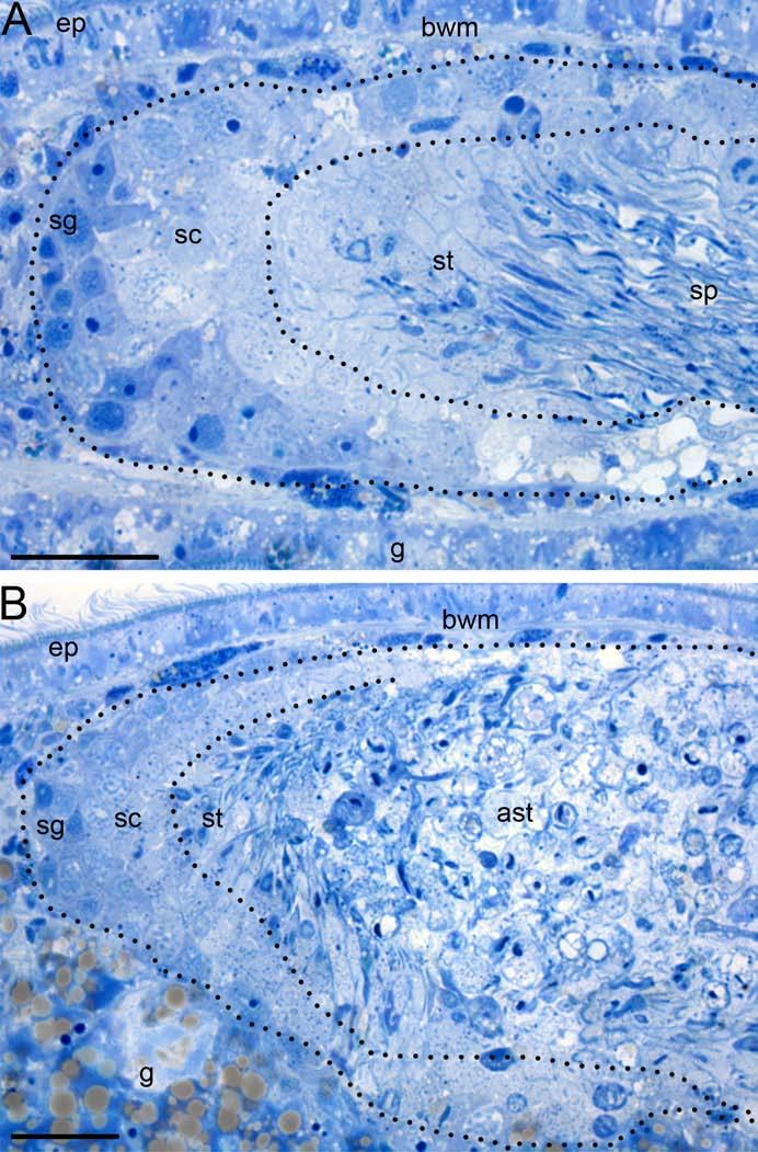 Figure 6: Comparison of the spermatogenesis of control and melav2 RNAi treated M. lignano.