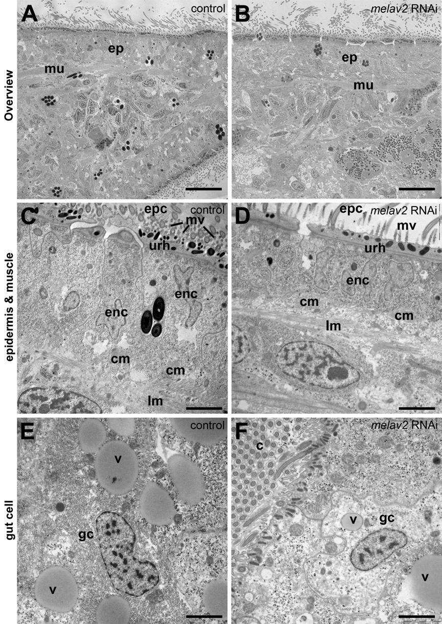 Additional file 3 :Comparison of tissue organization, epidermal-, muscle, and gut cell morphology of control and melav2 RNAi treated M. lignano.