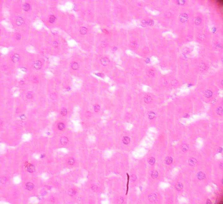 section of rats treated with MEBFV1 + CCl 4, (I) Liver section of rats treated with MEBFV2 + CCl 4, (J) Liver section of rats treated with PEEWFV1 + CCl 4, (K) Liver section of rats treated with