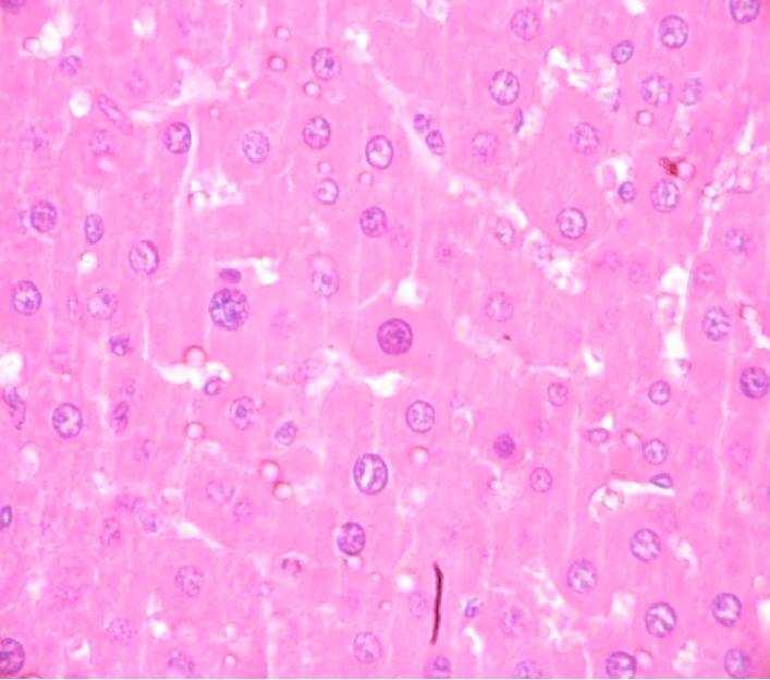 of rats treated with MEWFV2 + CCl 4 Liver sections of normal control rats (A) showing: normal hepatic cells with well-preserved cytoplasm; prominent nucleus.