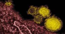 Enterovirus Influenza CRE