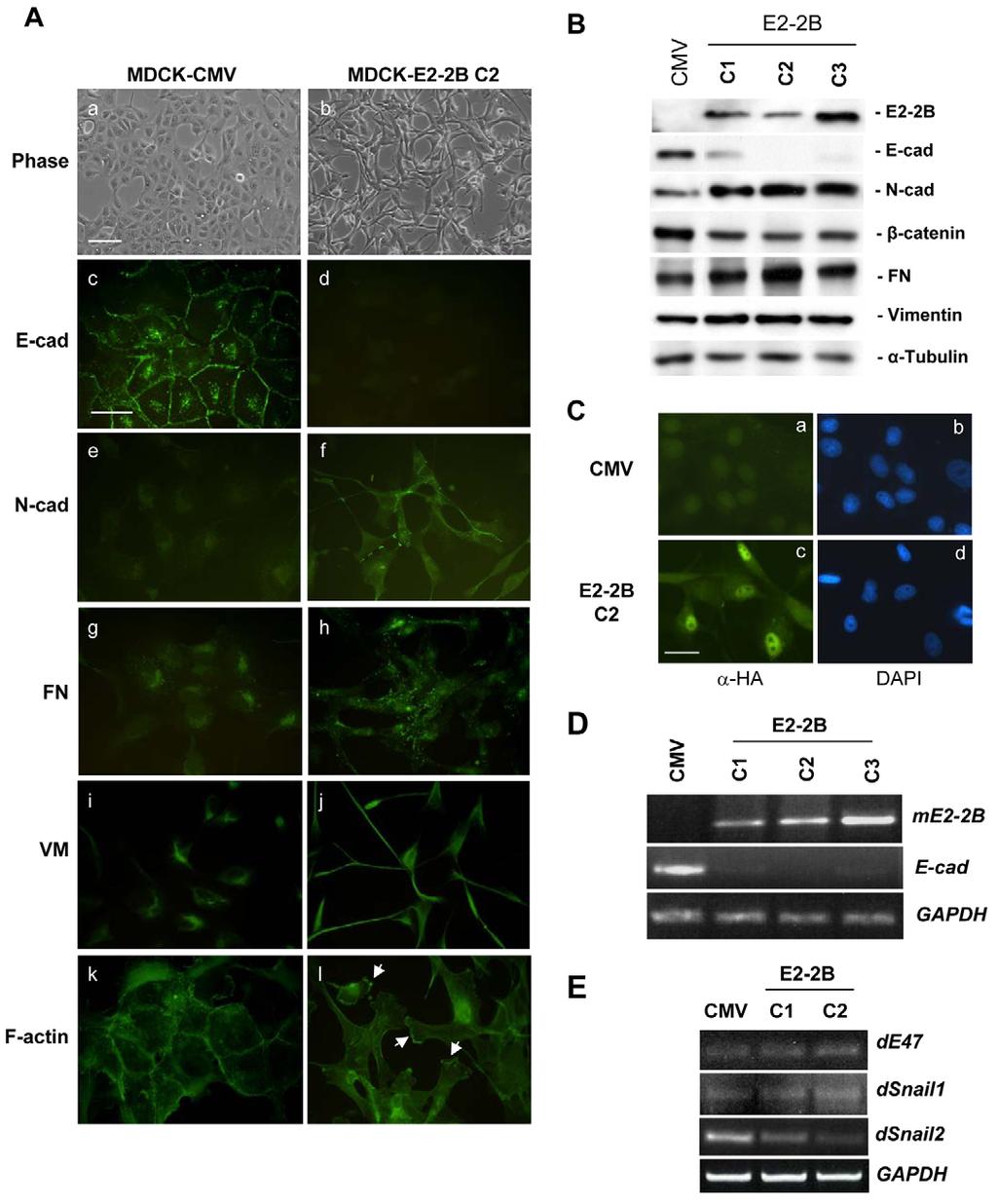 1016 Journal of Cell Science 122 (7) Journal of Cell Science Fig. 1. E2-2B induces a full EMT when overexpressed in MDCK cells. (A) Phenotypic characterisation of MDCK-E2-2B cells.