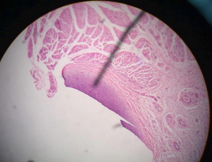 *Notice hyaline cartilage (chondrocyte inside lacunae, basophilic, form a nest). *At the surface is the pericondrium which contains chondroblast cells.