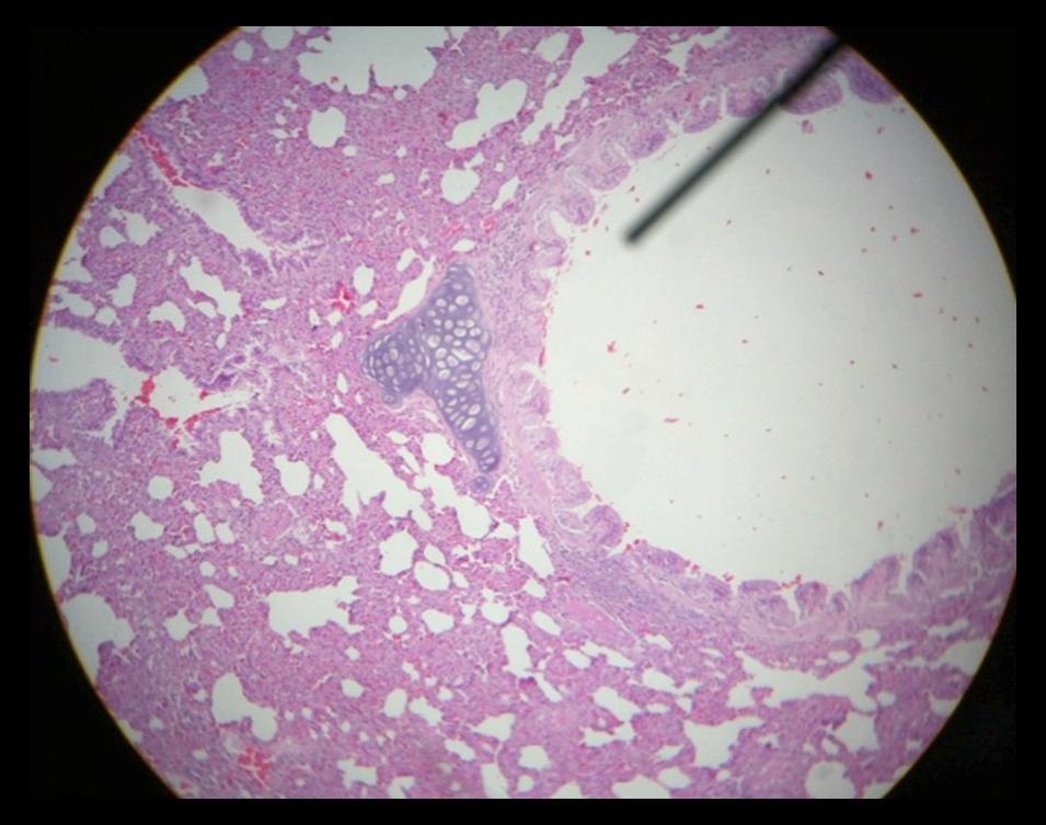 Lung Tissue Epithelial Foldings A Plate of Cartilage LUMEN *REMEMBER: Goblet cell > Mucus secretions Glands> Seromucus secretions