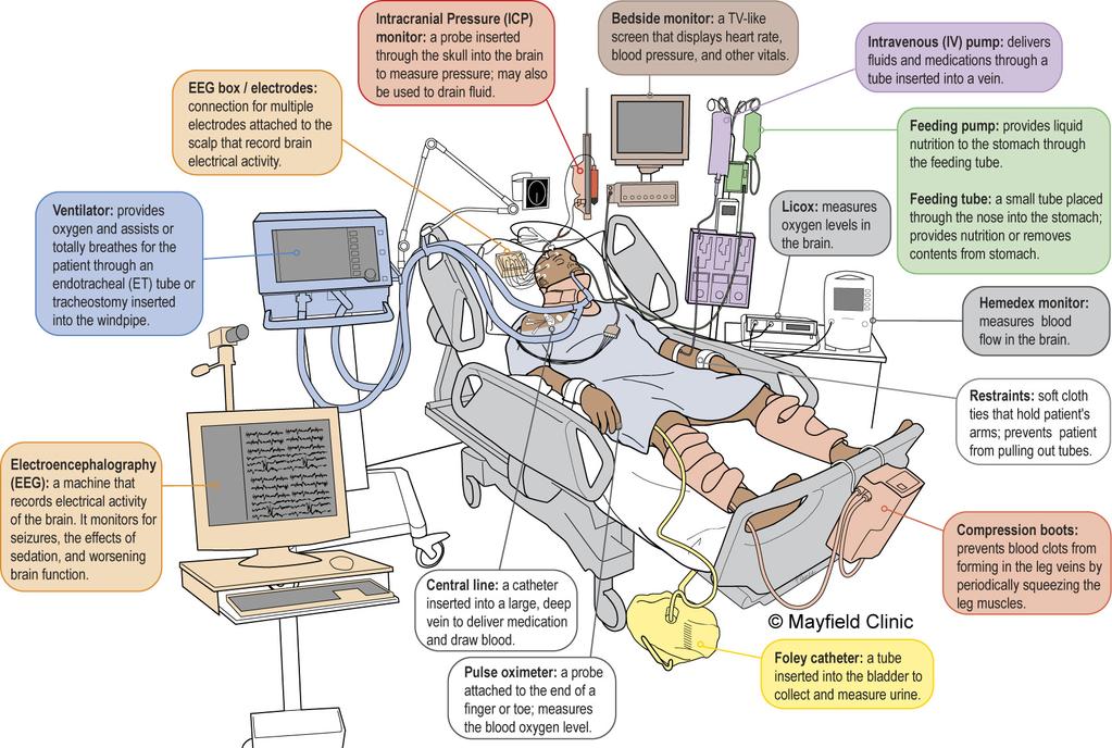 Figure 4. In the NSICU, the patient is connected to numerous machines, tubes, and monitors. The monitoring equipment provides information about body functions and helps guide care.