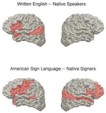 Brain Imaging of Sign