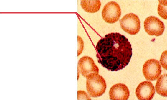 EOSINOPHIL 1-4% of Leukocytes 5 Contains large red- staining granules Usually 2 lobes 12-17 µm: about the size of