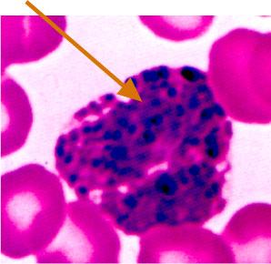 BASOPHIL < 1% of Leukocytes 6 Contains large blue- staining granules Usually 2 lobes (often concealed) 10-12 µm:
