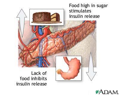 Insulin Resistance Constant exposure to high-concentrations of