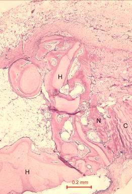 Photomicrograph of bony defect grafted with quercetin in