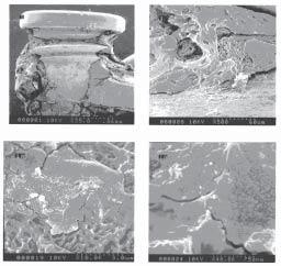 Figure 8. Scanning electron micrographs of mini-implants retrieved from rat femur, showing the apposition of bone to the implant surface.