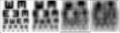 Modeling, 3.0 mm Pupil IC-8 Small Aperture IOL Extended Depth of Focus (TC -0.75D) 0.0 D -0.5 D -1.0 D -1.5 D -2.0 D -2.5 D Standard Mono-focal 0.0 D -0.5 D -1.0 D -1.5 D -2.0 D -2.5 D Diffractive Bi-focal 0.